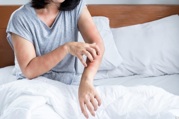 The Challenges of Food Allergies